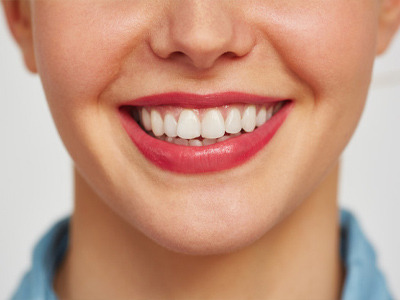 implantes dentales en Málaga tratamiento