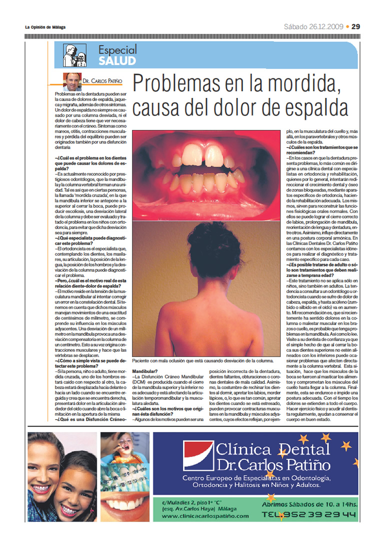 Implantes Dentales en Málaga