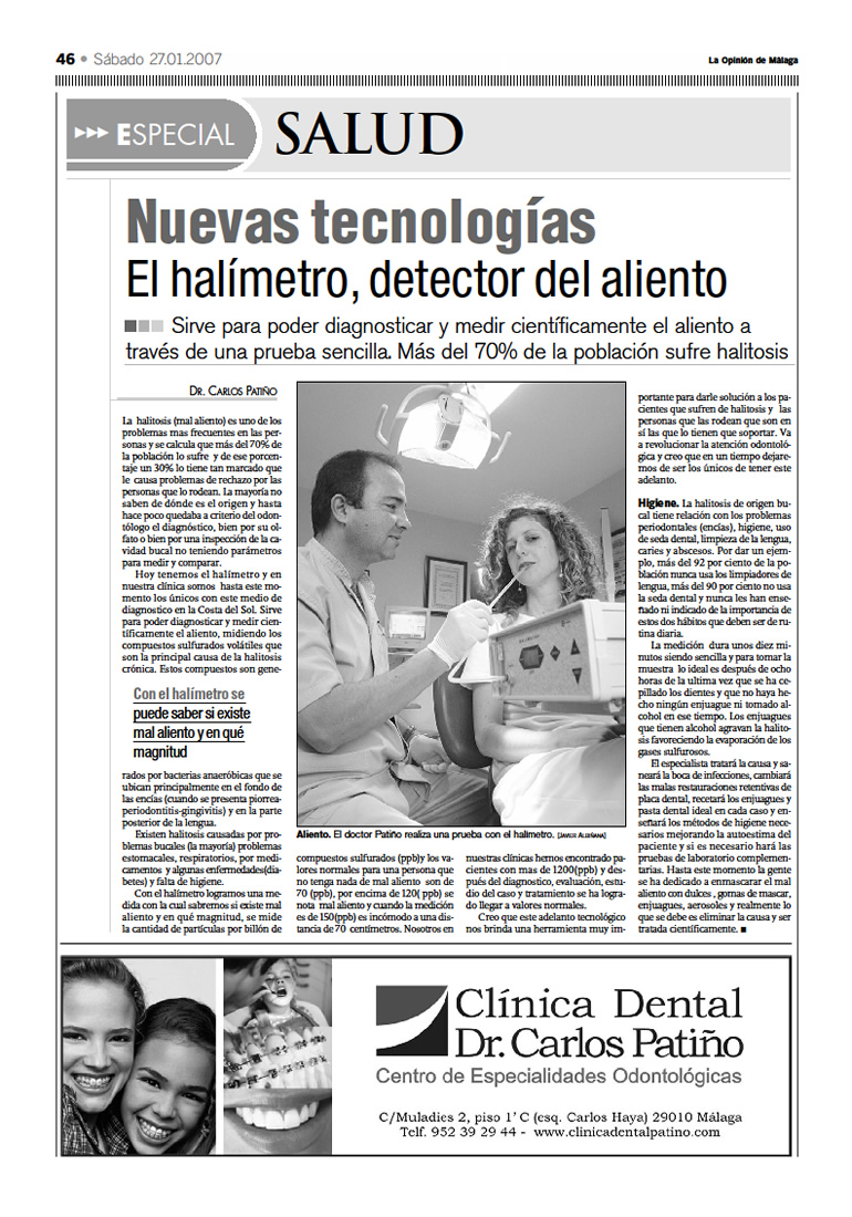 Implantes Dentales en Málaga